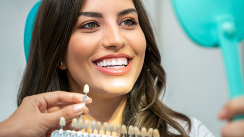 A smiling woman comparing shades of veneers at the dentist