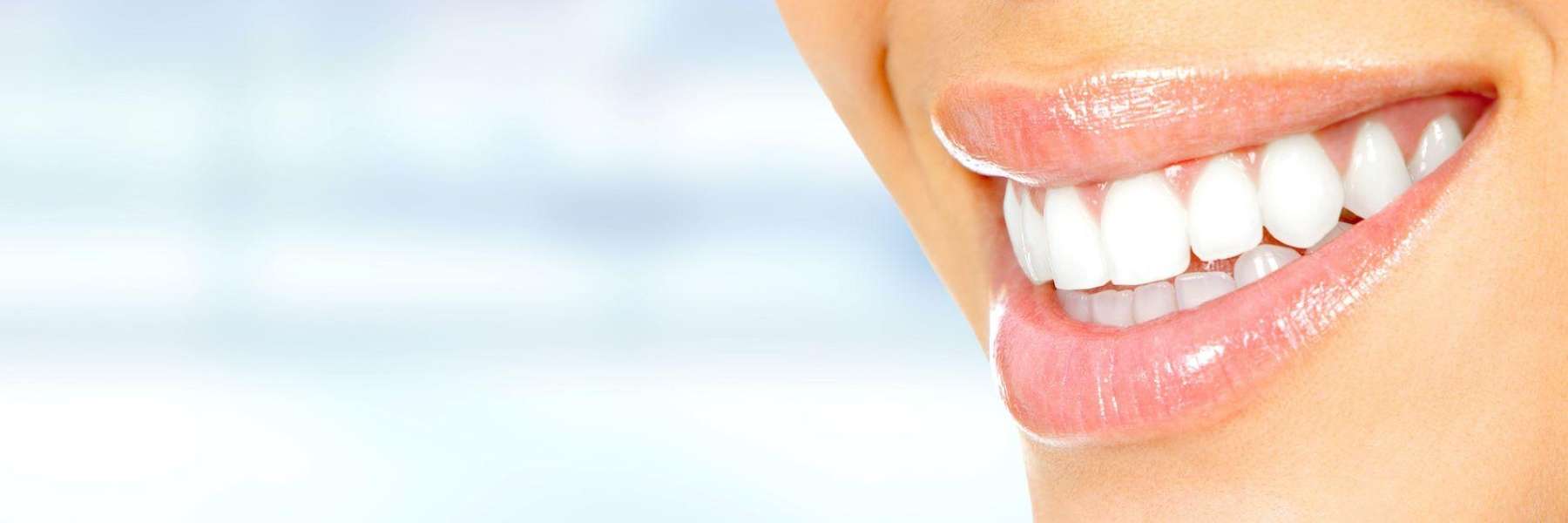 A woman with white teeth smiling | dentist in Greeley